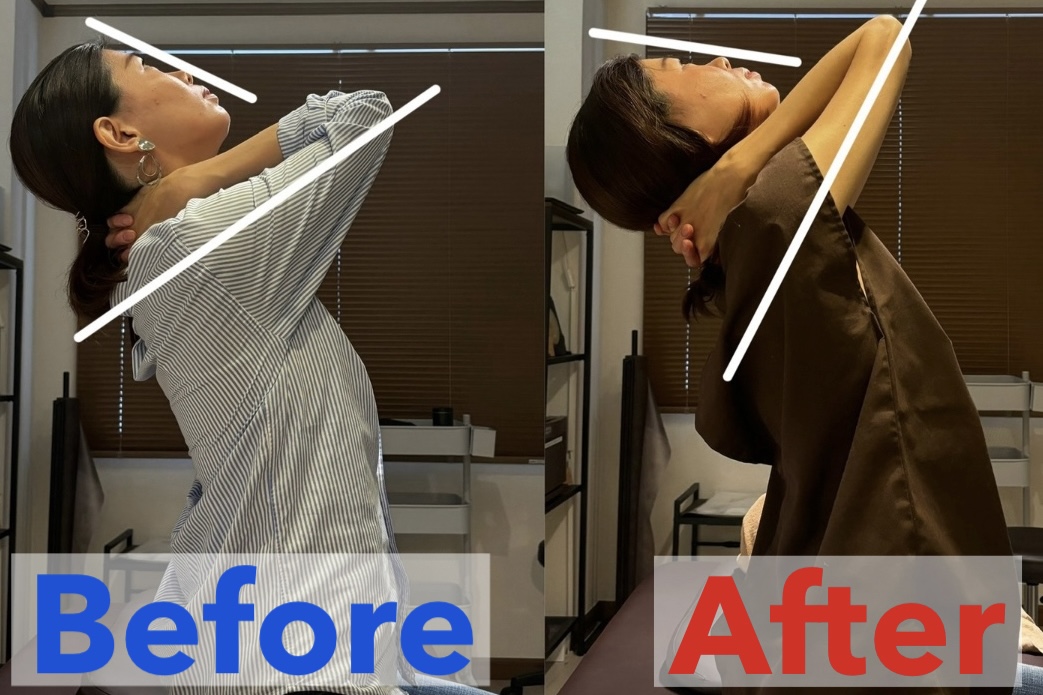 アスモット鍼灸整体院 【腰痛・肩こり解消】整体コースのメニュー画像