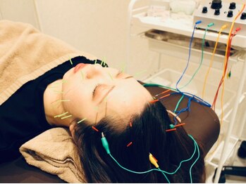 くまのみ整骨院 草加院 【初回限定】美容鍼＋パルスのメニュー画像