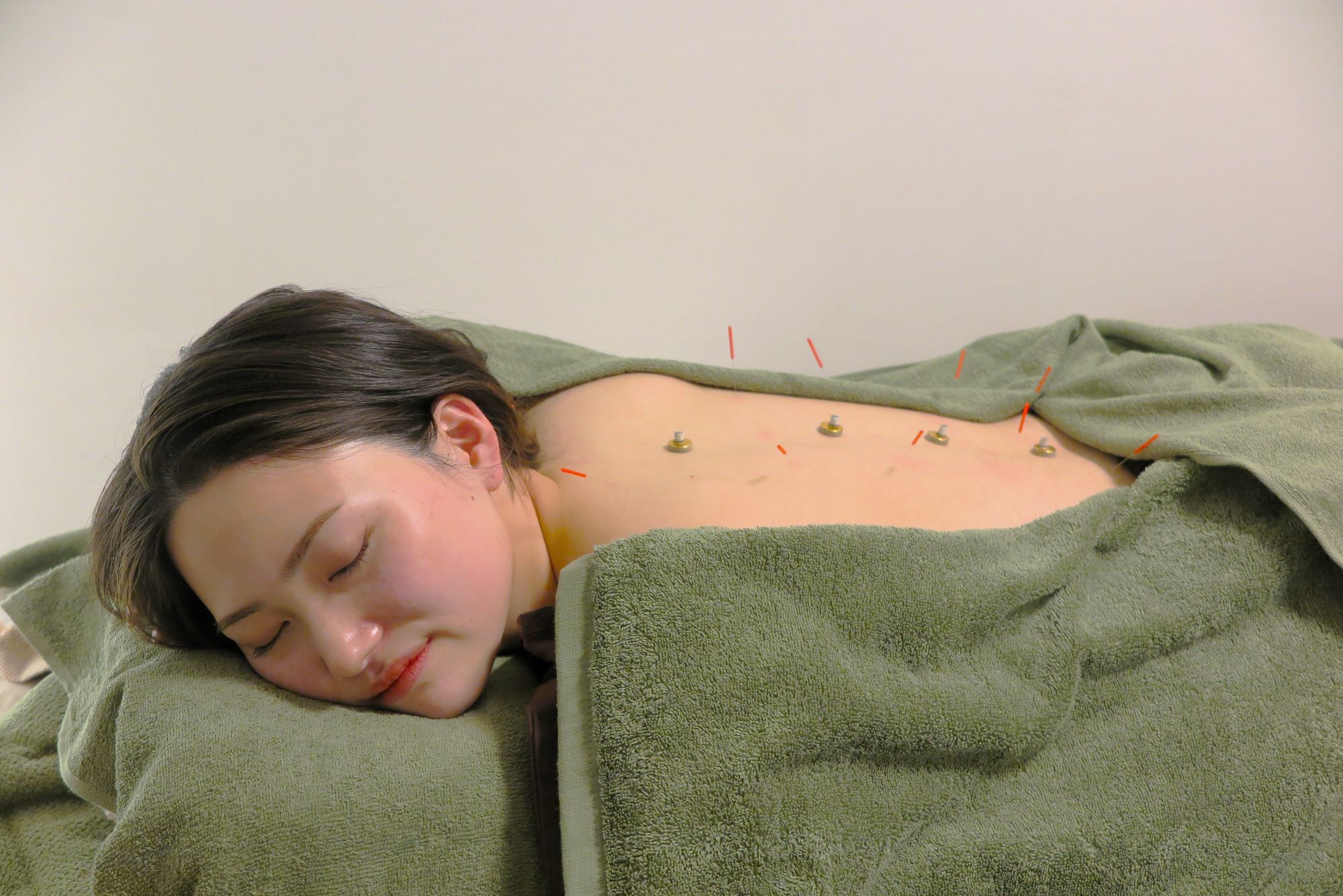 神保町色彩鍼療所｜完全予約制｜美容鍼・鍼灸 鍼灸全身コースのメニュー画像