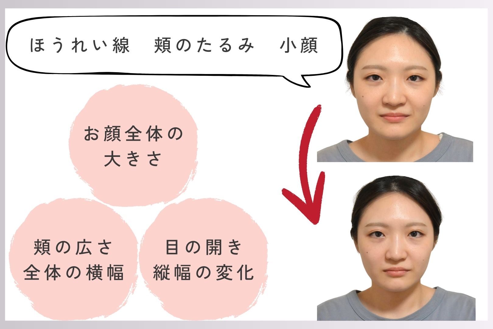 真ごころ鍼灸院【東洋医学・はりとお灸専門】 【初めての方】お身体の治療＋お顔のシワ・たるみ・ほうれい線改善のメニュー画像