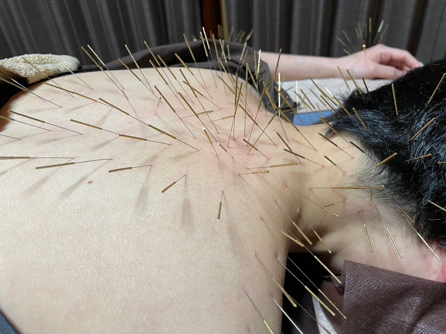 からほり　野の花堂　かつらぎ町出張所 ルート鍼 60分 標準治療のメニュー画像