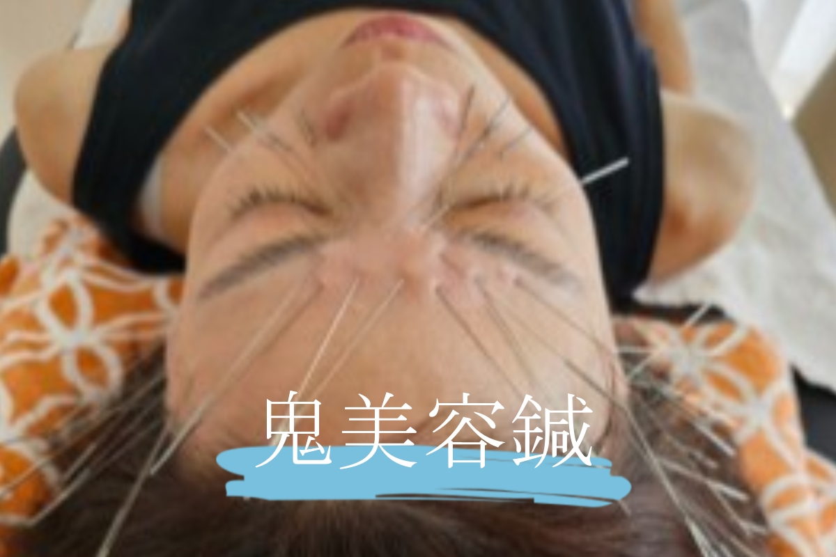 KANALOA鍼灸院 鬼美容鍼のメニュー画像