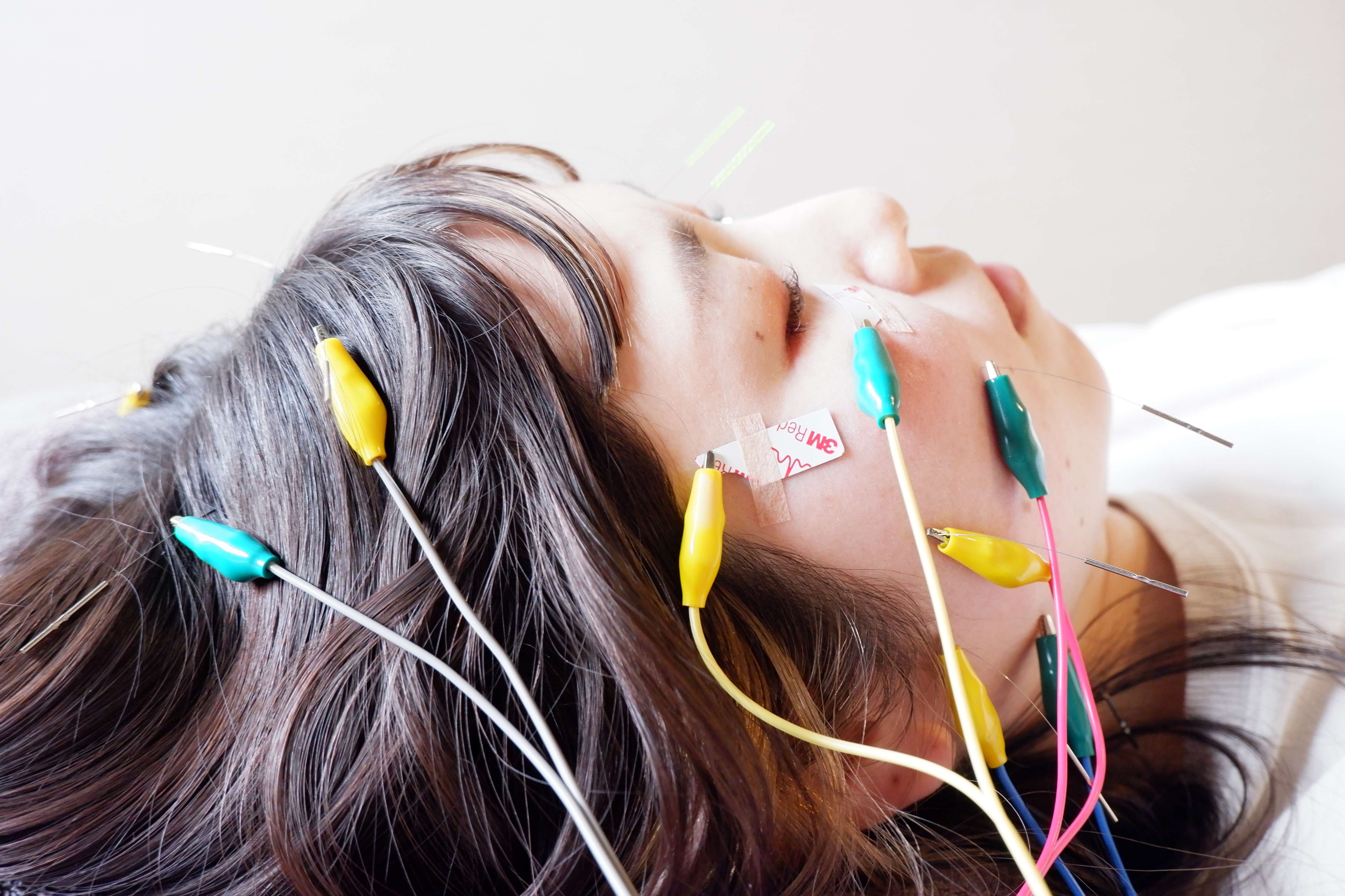 お灸の森　親子で通えるマッサージ・鍼灸院 リフトアップ＋低周波美容鍼 　2回目以降のメニュー画像