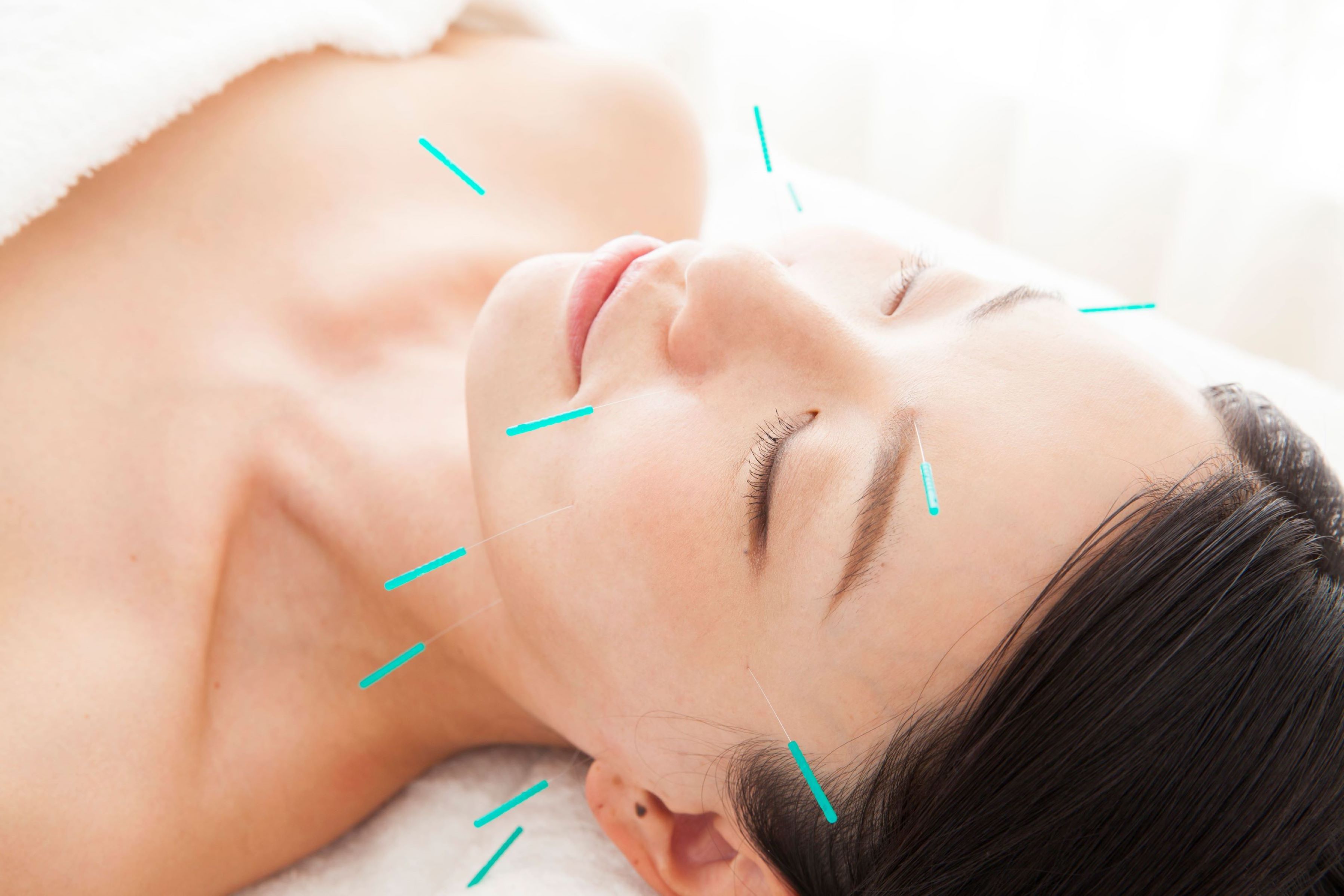 レディース鍼灸治療院Sis. 近鉄奈良駅前院 お手軽美容鍼コースのメニュー画像