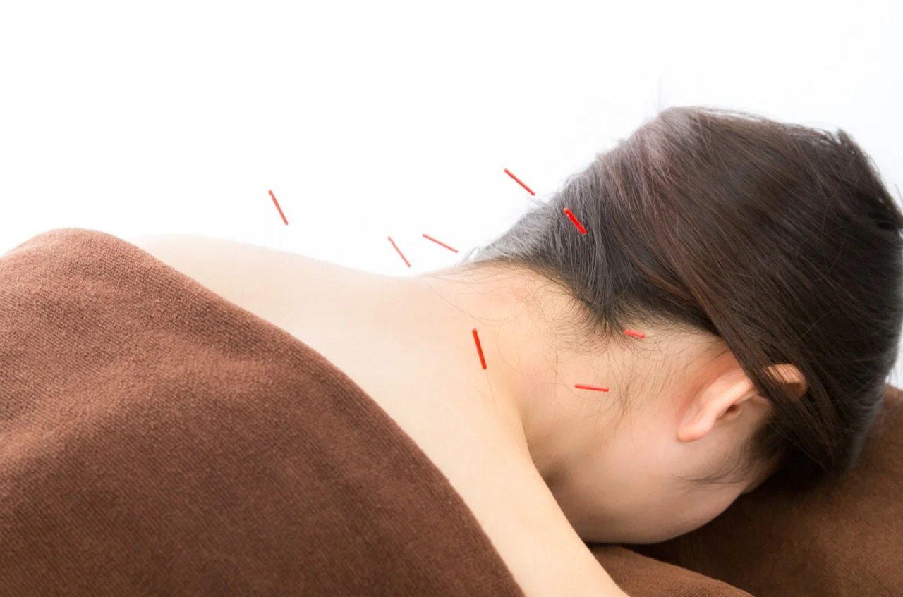 鍼灸院みらい京都桂 ２回目以降の方【全身調整とパルス美顔鍼のコース】のメニュー画像
