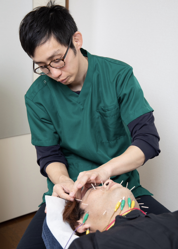 中野区野方鍼灸院のむち鍼 【毎月5名限定】たるみ・肌のトーンアップにモテ肌をつくる美容鍼【たるみ・むくみ・リフトアップ・眼精疲労】（初回）男性にも大人気！のメニュー画像