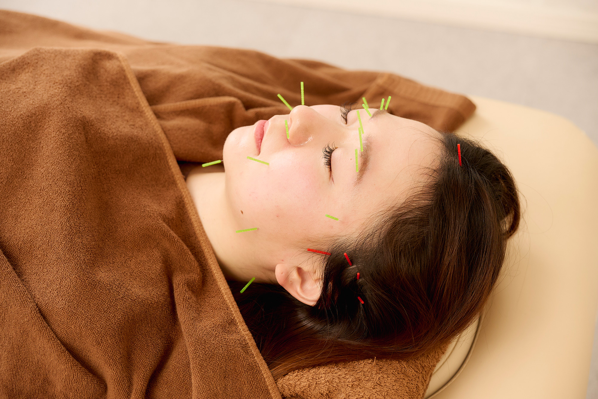 鍼灸サロンシエスタ 美容鍼灸のメニュー画像