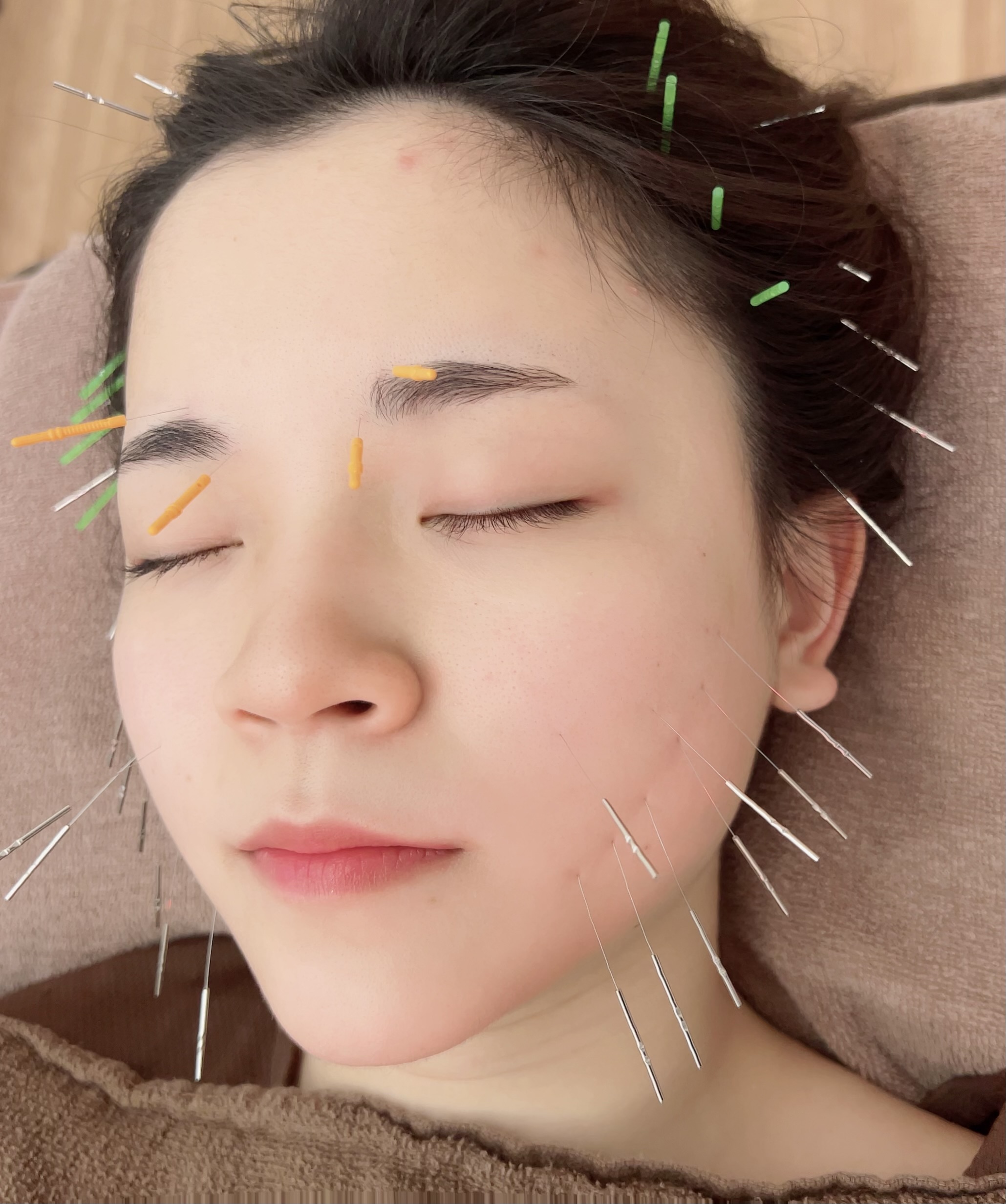 美容鍼・はりきゅうサロン　笑陽堂 ⭐︎リフトアップ⭐︎立体造顔美容鍼コースのメニュー画像