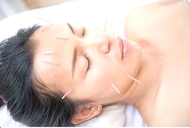 ふじおか鍼灸院 くいしばり鍼のメニュー画像