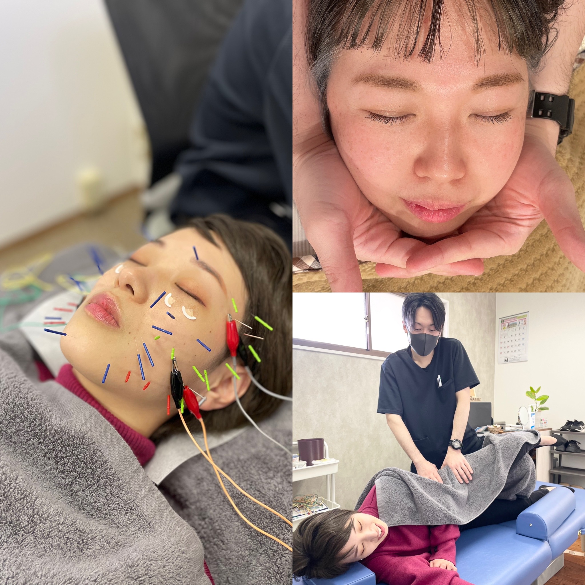 美容鍼サロン　harry's N (初回)美容鍼×小顔矯正×鍼灸整体プレミアムコース　¥15,000→¥13,000のメニュー画像