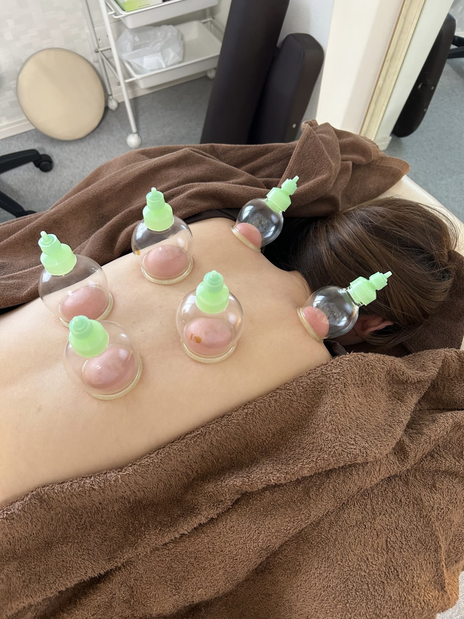 鍼灸サロンシエスタ オイルカッピング+鍼灸のメニュー画像