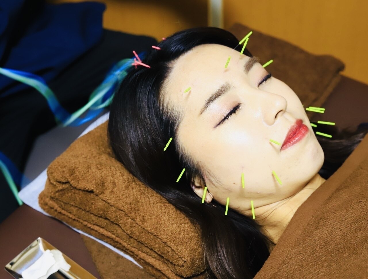 くにたちNyan鍼灸整体院 【美容鍼】むくみ・目元のシワ・たるみケア!肌質改善も♪ 40分のメニュー画像