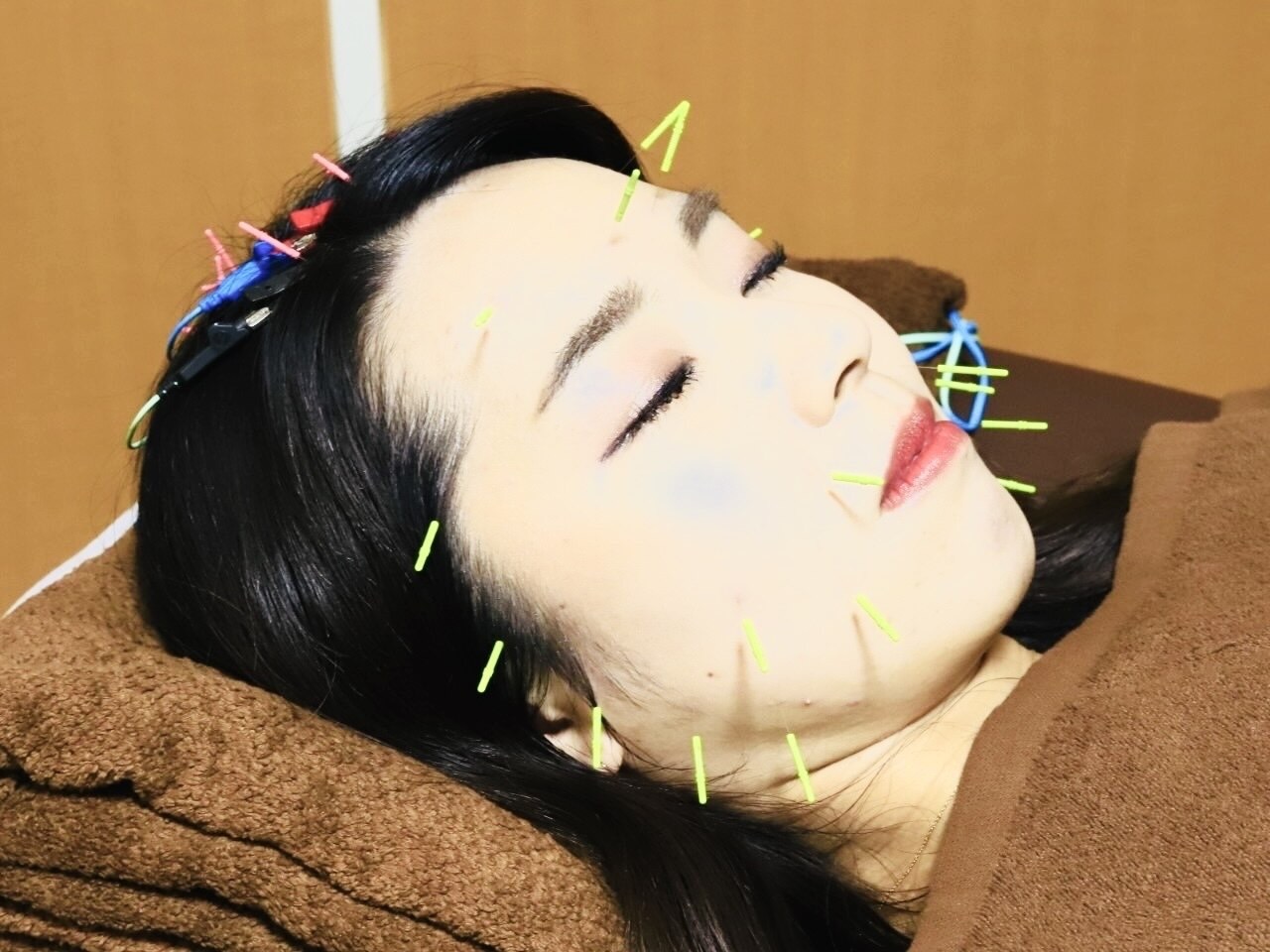 くにたちNyan鍼灸整体院 【美容鍼+頭皮鍼】頭皮から小顔へ☆エラのハリや頭痛も改善! 60分のメニュー画像