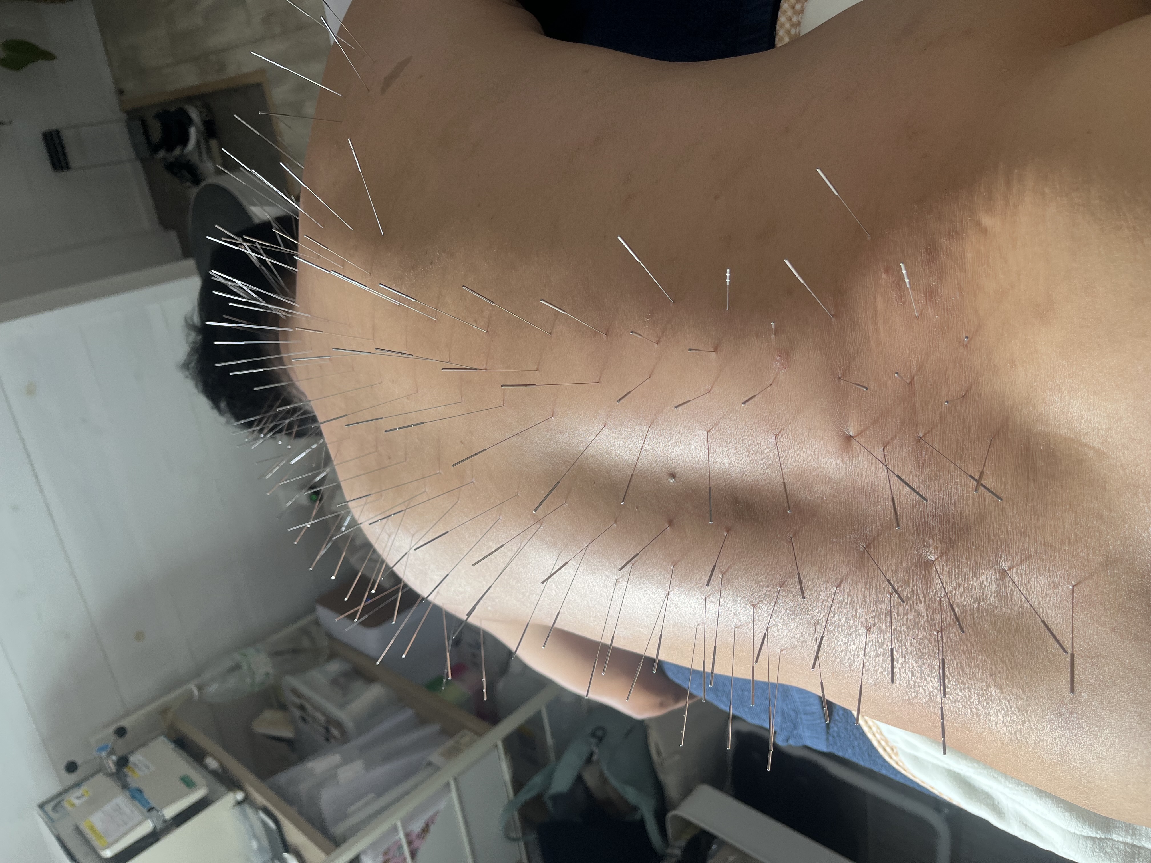 鍼灸salon　 ASENS   ルート治療院 【姫路大津院】ルート鍼治療60分のメニュー画像