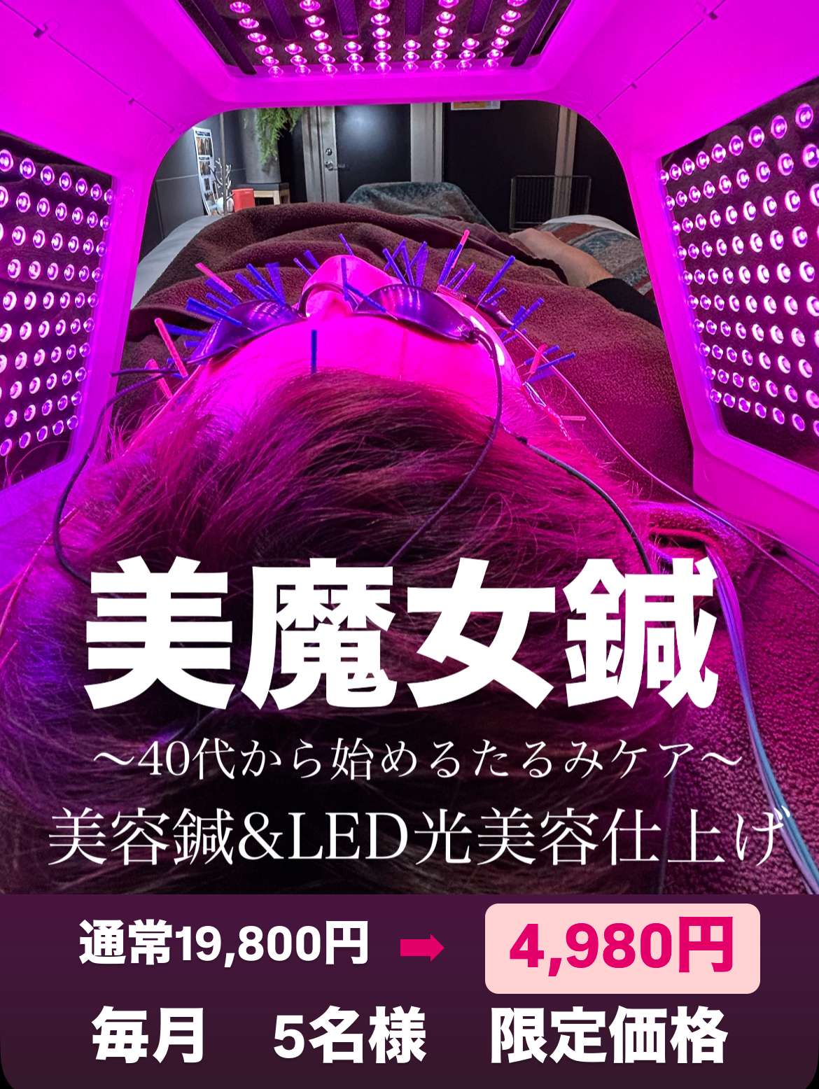 美鍼堂 美魔女鍼のメニュー画像