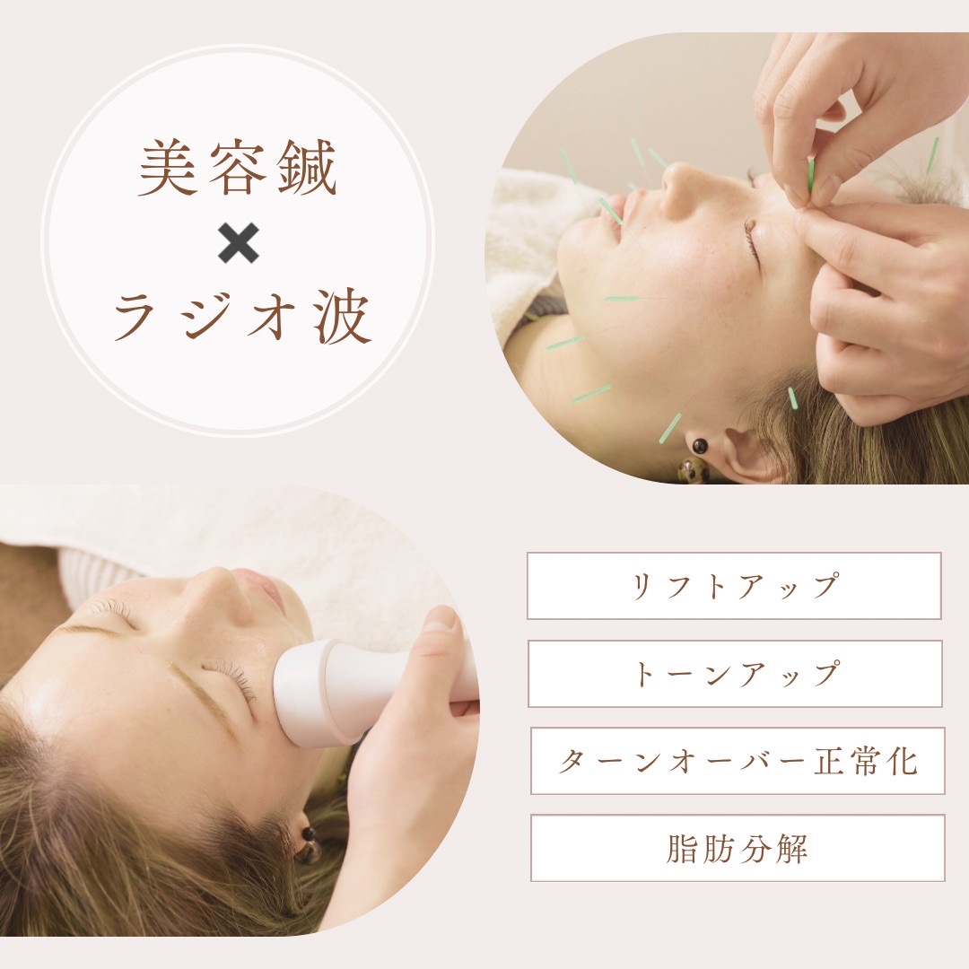 はり・きゅう治療院 縁 (えにし) 美容鍼×ラジオ波(RF)のメニュー画像