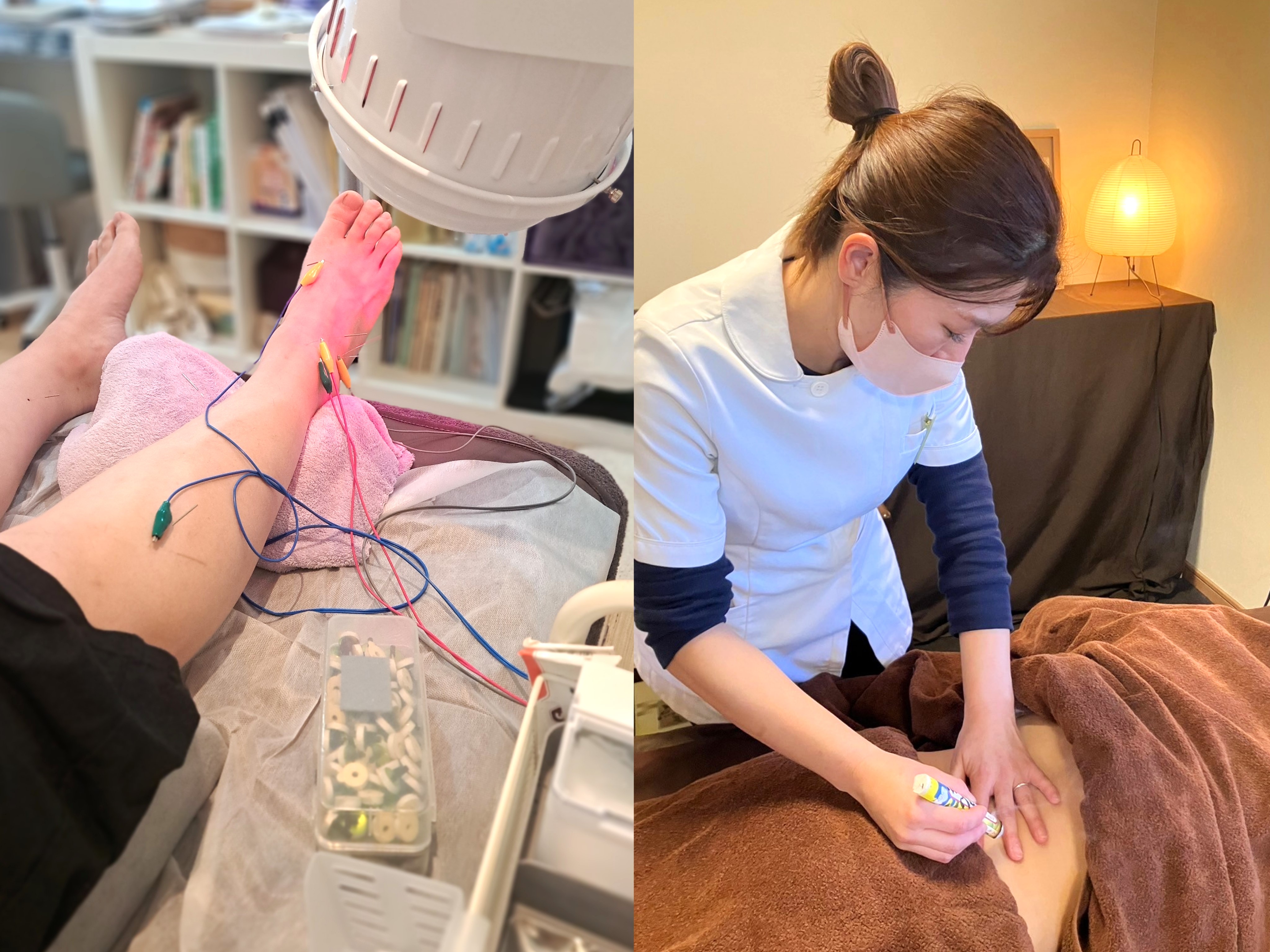 むすび治療院 鍼灸ショートコースのメニュー画像