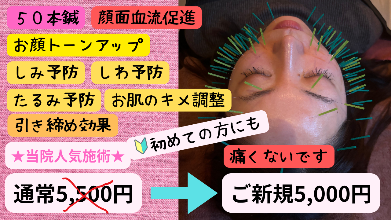 鍼灸治療院 寛ぎ 【ご新規様限定】高級鍼使用美容鍼50本のメニュー画像