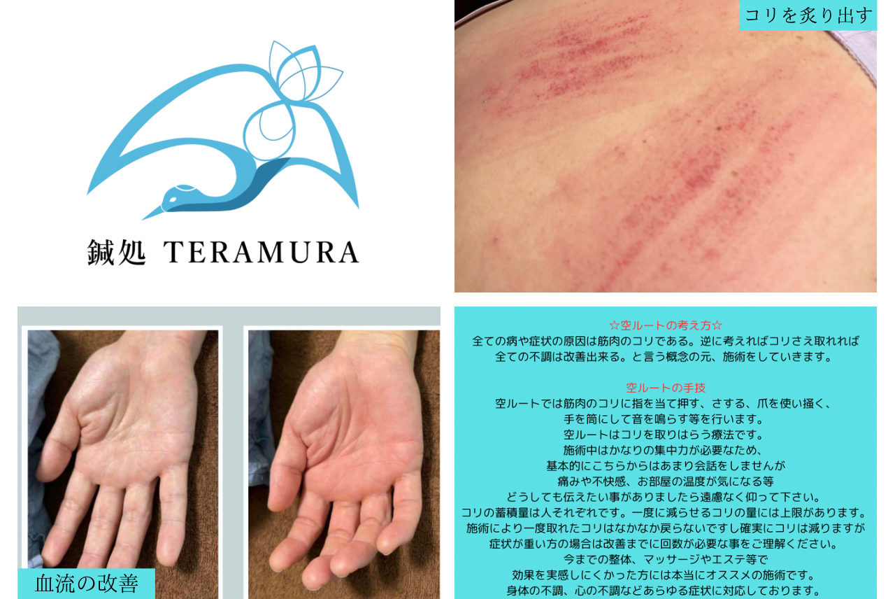 鍼処TERAMURA　山口県下関市　ルート治療認定院 空ルートのメニュー画像