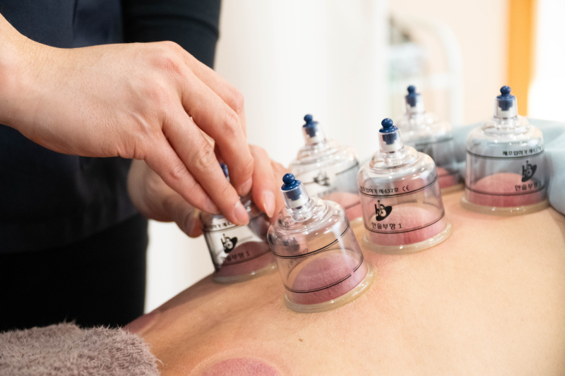 むすび治療院 カッピング(1部位)のメニュー画像