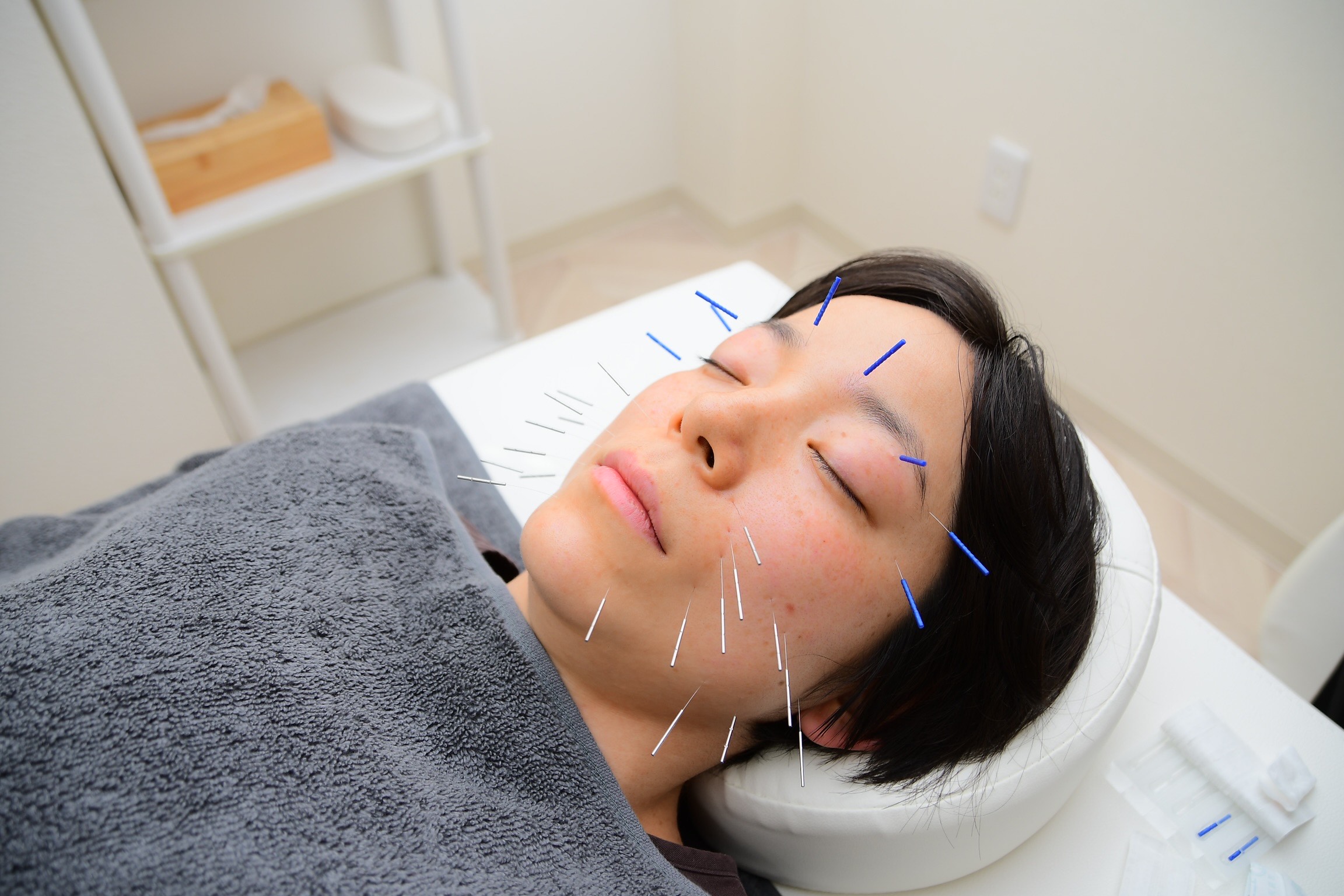 はりきゅう整体サロンCoco 美容鍼灸のみ 30分のメニュー画像