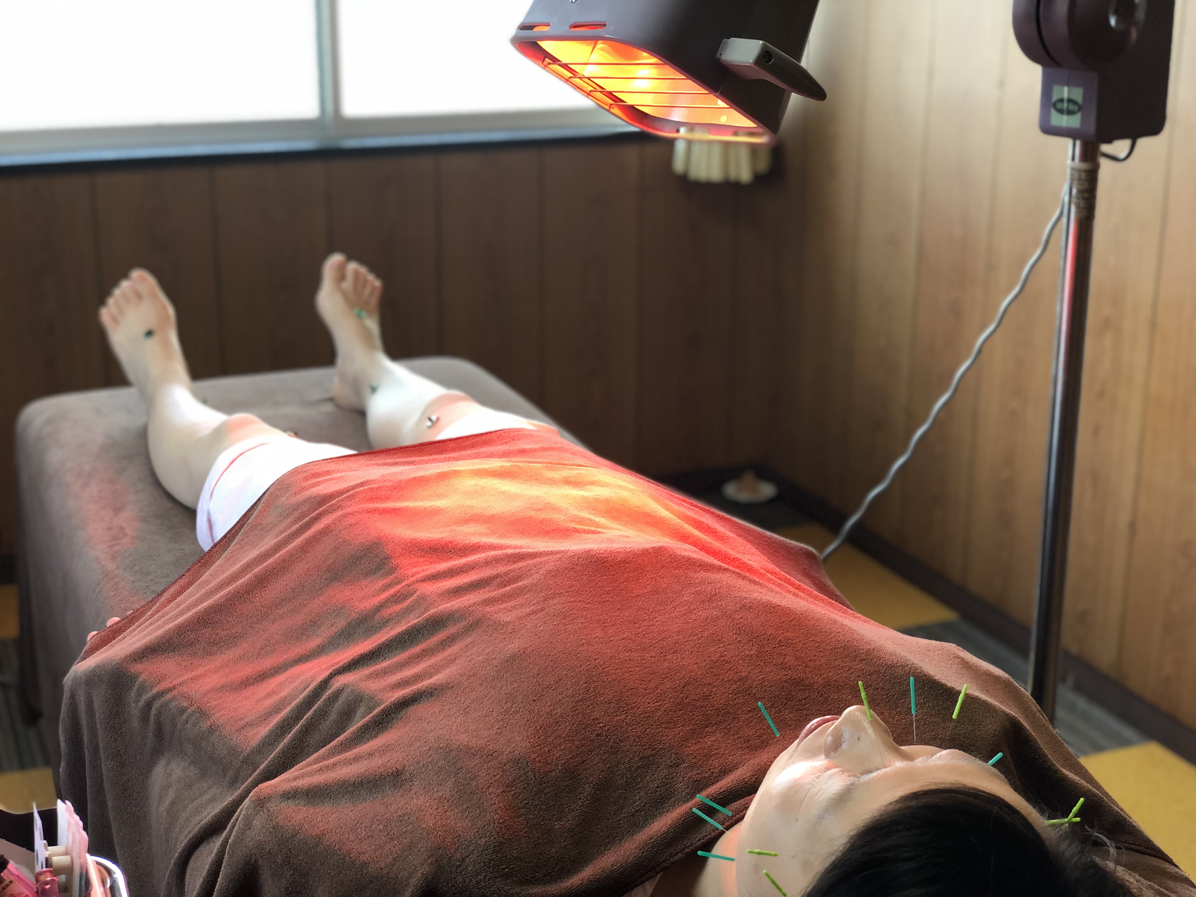 晋の鍼灸院~トータルビューティーラボ~ 美容健康トータルコース(お試し美容鍼)のメニュー画像