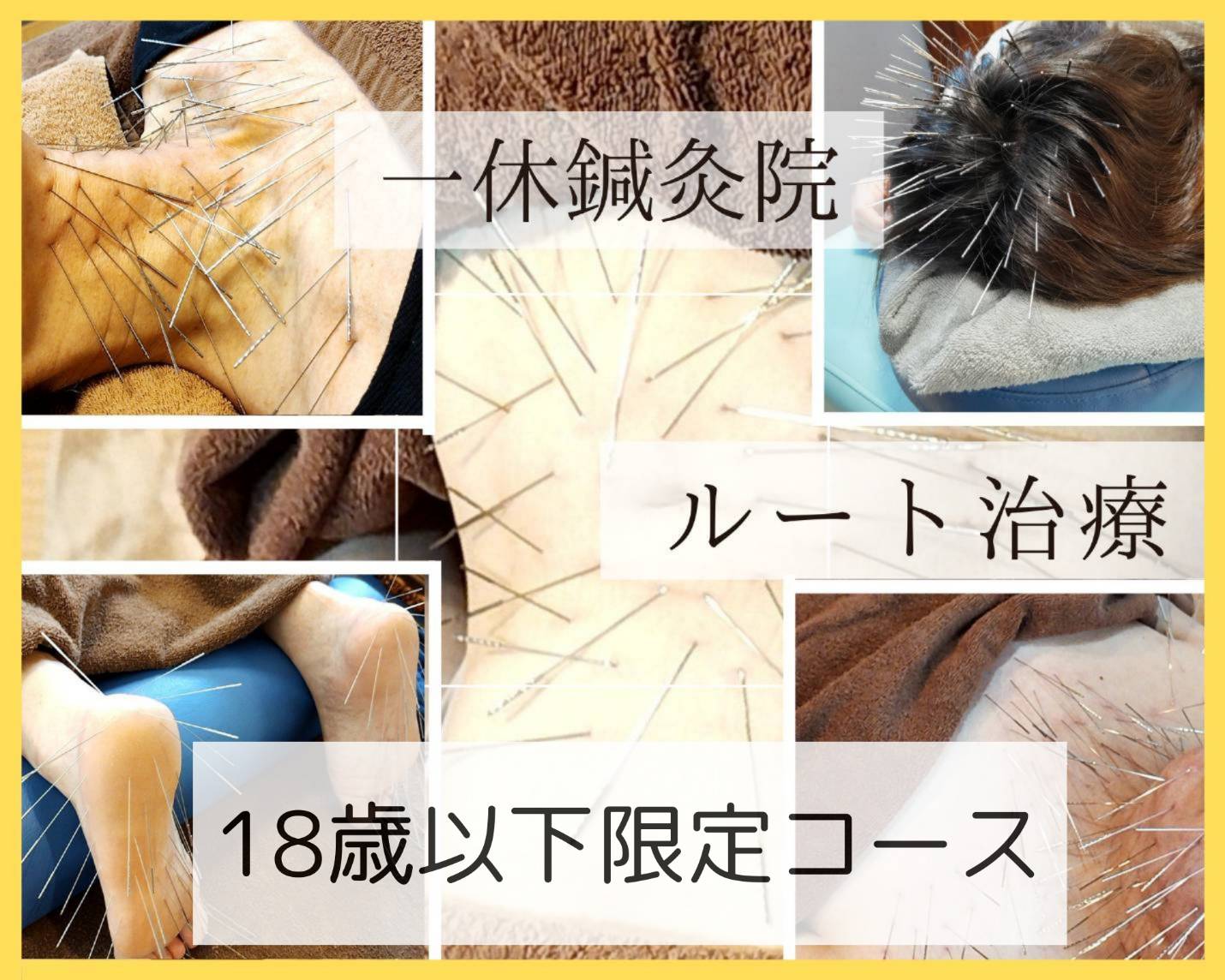 一休鍼灸院　ルート治療専門院 ルート治療(18歳以下)1枠【午後】12:00〜22:00　一休出張所のメニュー画像