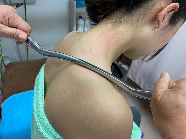 國安鍼灸整骨院　中野院 フィシアスリックテニック（グラストンテクニック）一部位のメニュー画像