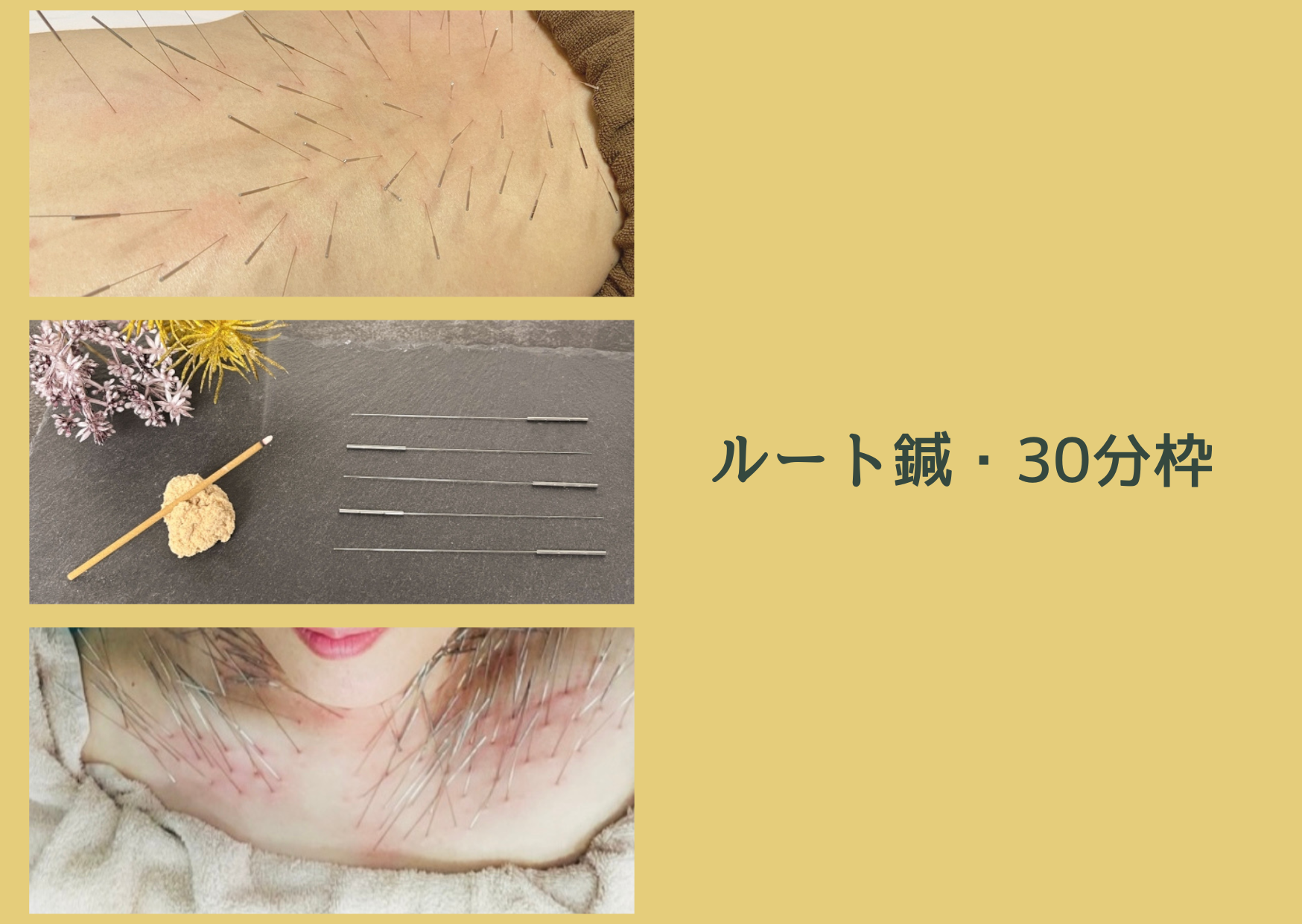ゆり鍼灸院 📍ルート・30分枠のメニュー画像