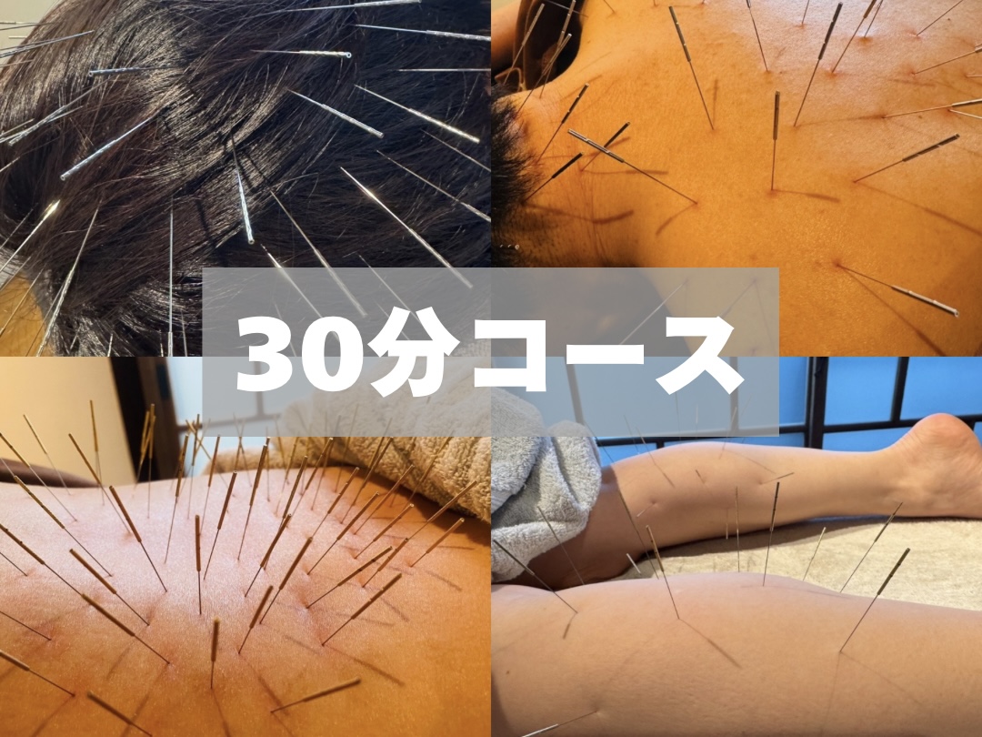 鍼処KEN ルート治療ポイント（約30分）のメニュー画像