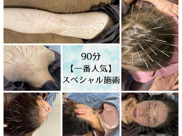 リーブル針灸院 南町田ルート治療 ルート治療　９０分【全身治療】のメニュー画像