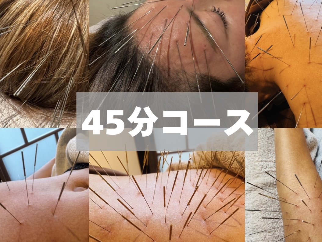 鍼処KEN ルート治療45（約45分）のメニュー画像