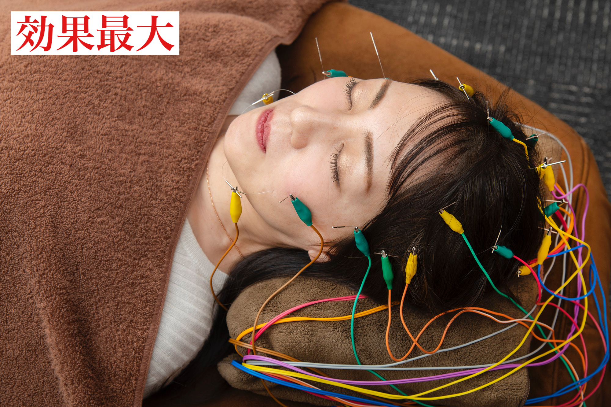 NatuRise 人気No. 1 超リフトアップ美容鍼のメニュー画像