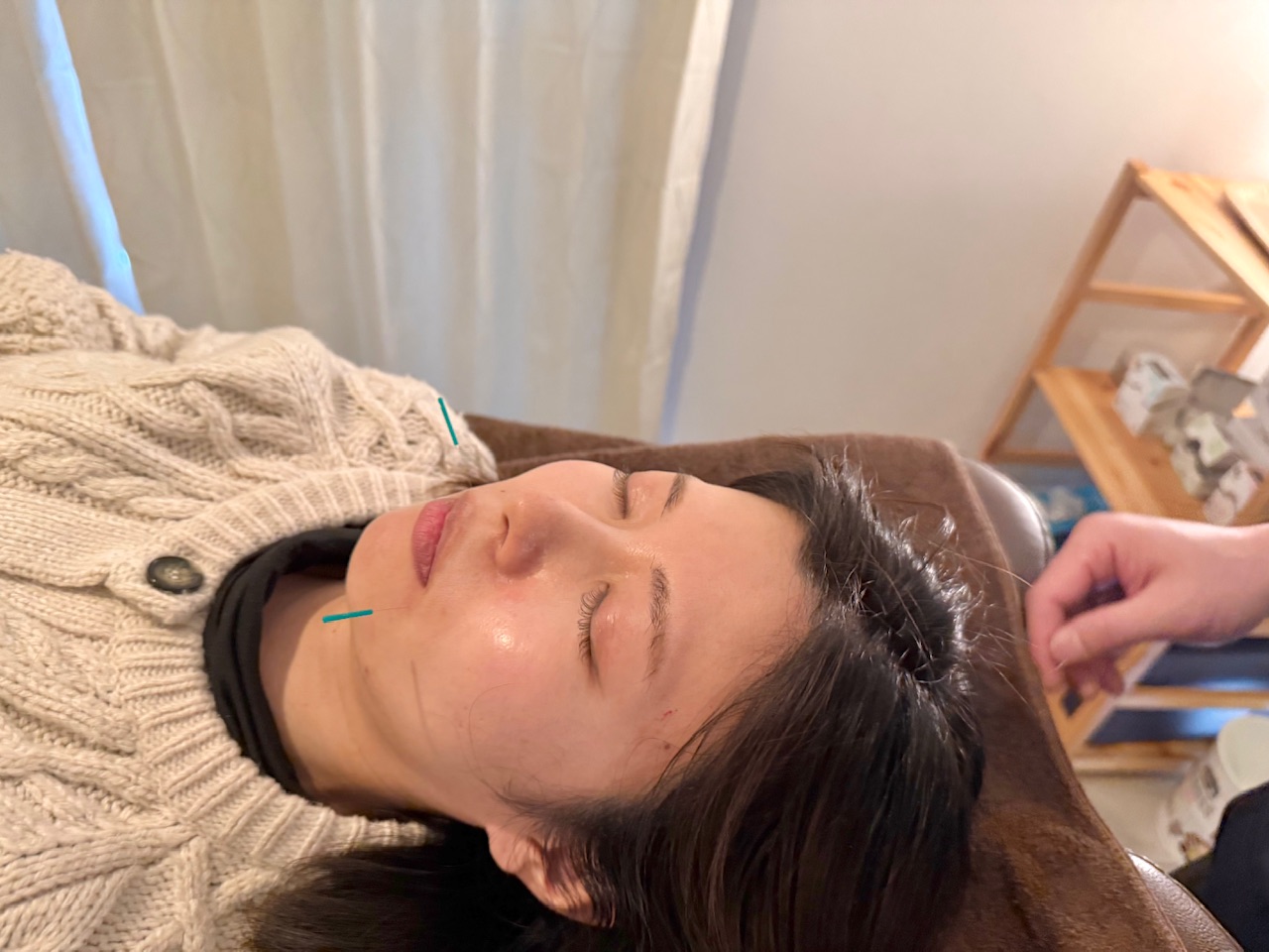 鍼灸マッサージサロン Pono Luana スペシャルPono式美容鍼のメニュー画像