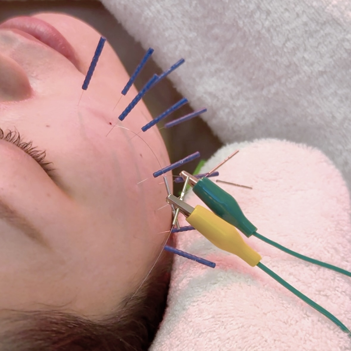 Hari Cherir 院詳細 | 甲府・山梨・笛吹の鍼灸院・美容鍼サロン