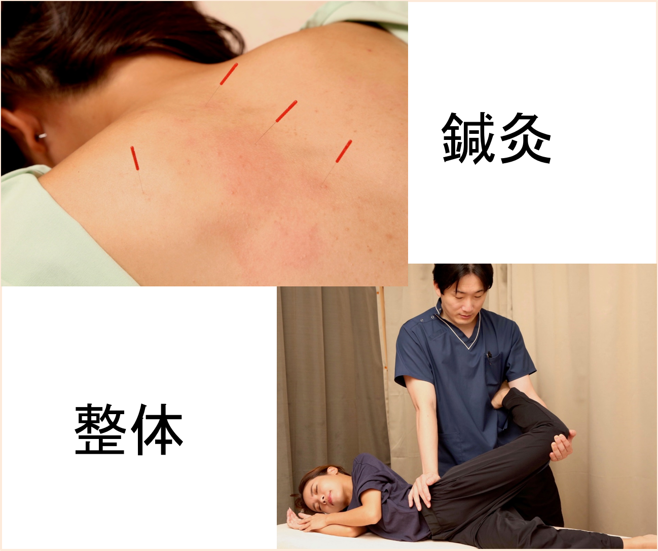鍼灸 整体　HARIS（ハリス：大阪本院） 鍼灸＆整体　健康セット　のメニュー画像