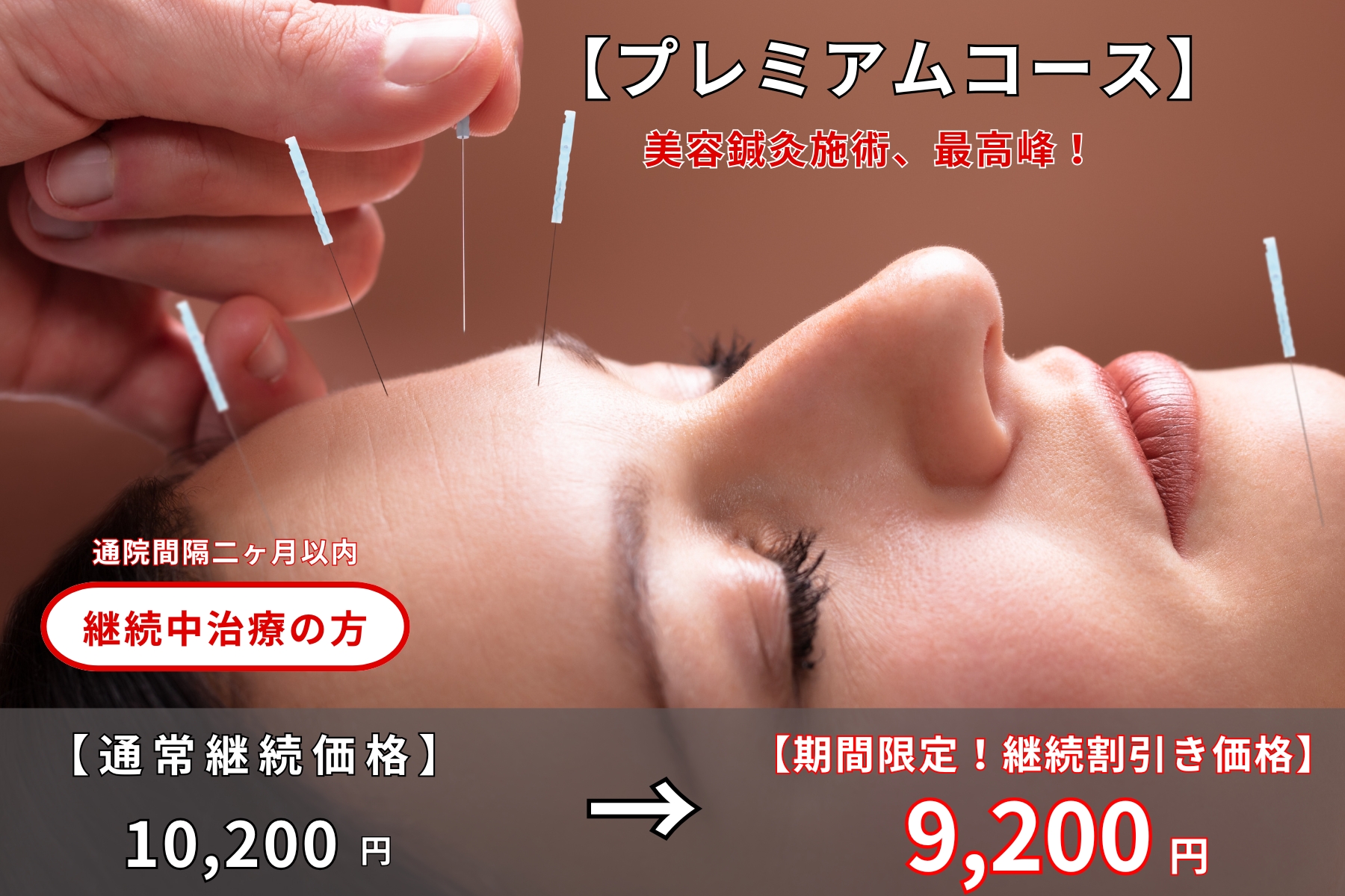 沖縄県那覇市首里スマイル鍼灸整骨院　本院 【初回特別限定割引キャンペーン】10200円→9200円｜体の美と顔の美を追求！美容鍼灸（プレミアムコース）マッサージ＋整体＋骨盤矯正＋骨格矯正＋鍼灸治療＋美容鍼｜リピーター続出！のメニュー画像