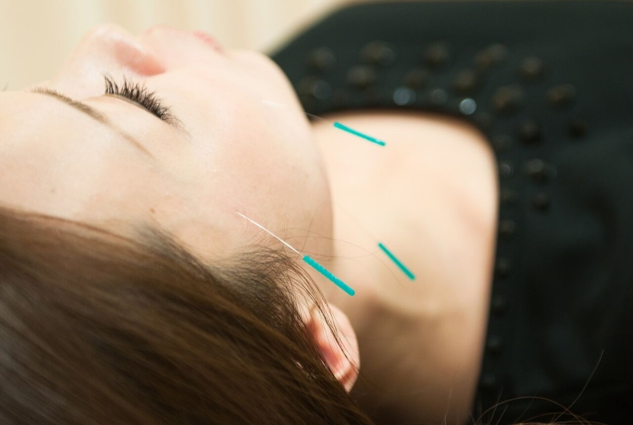 タイ古式マッサージ・美容鍼灸 PALM 美容鍼メンテナンスコースのメニュー画像