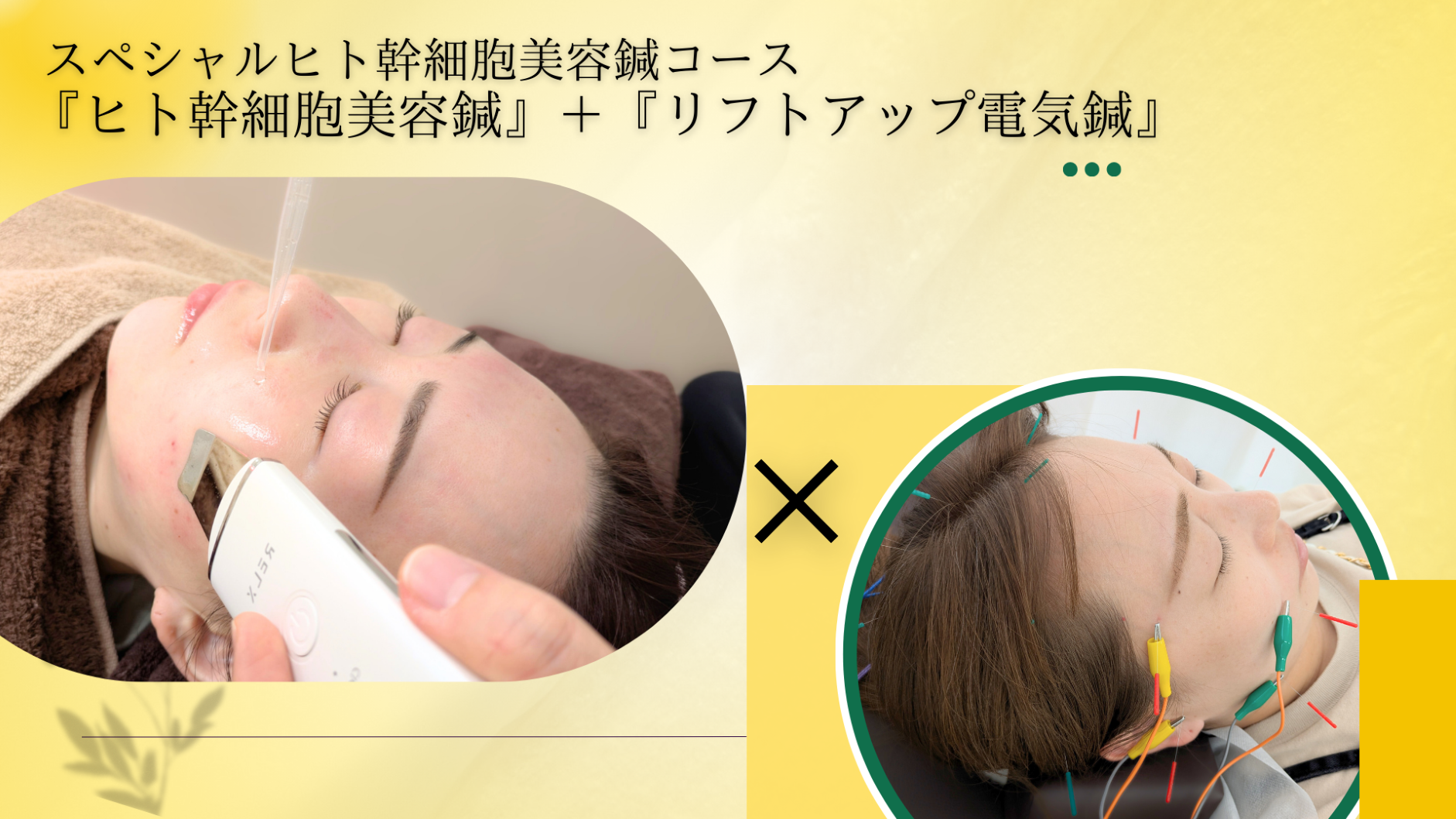はりきゅうeFu -エフ- 【2回目以降】ヒト幹細胞美容鍼＋リフトアップ電気鍼のメニュー画像