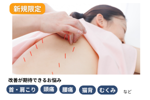 はり・きゅう治療院 縁 (えにし) 【新規限定】基本治療のメニュー画像