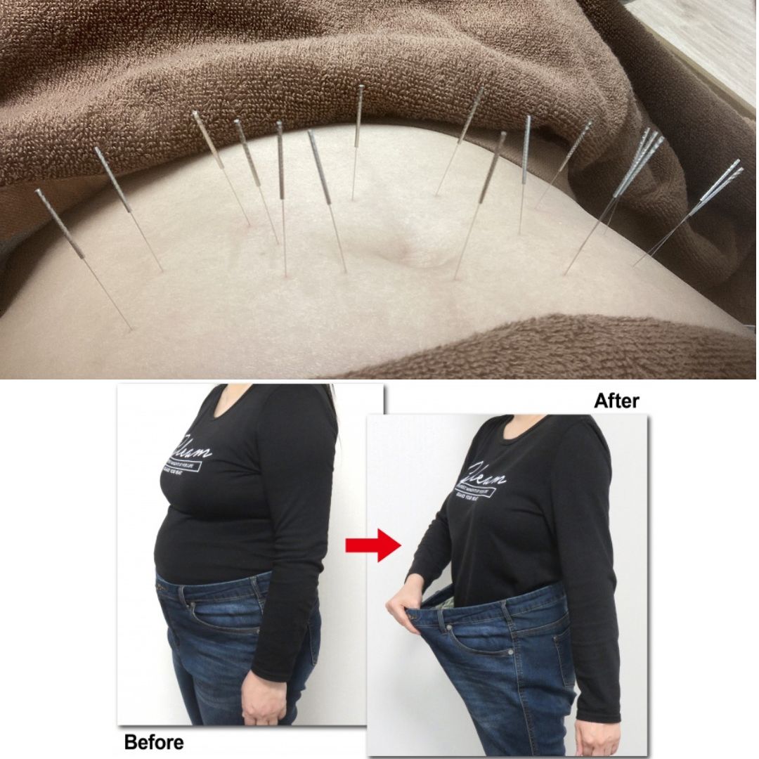 ふじおか鍼灸院 腸活瘦身鍼灸　のメニュー画像