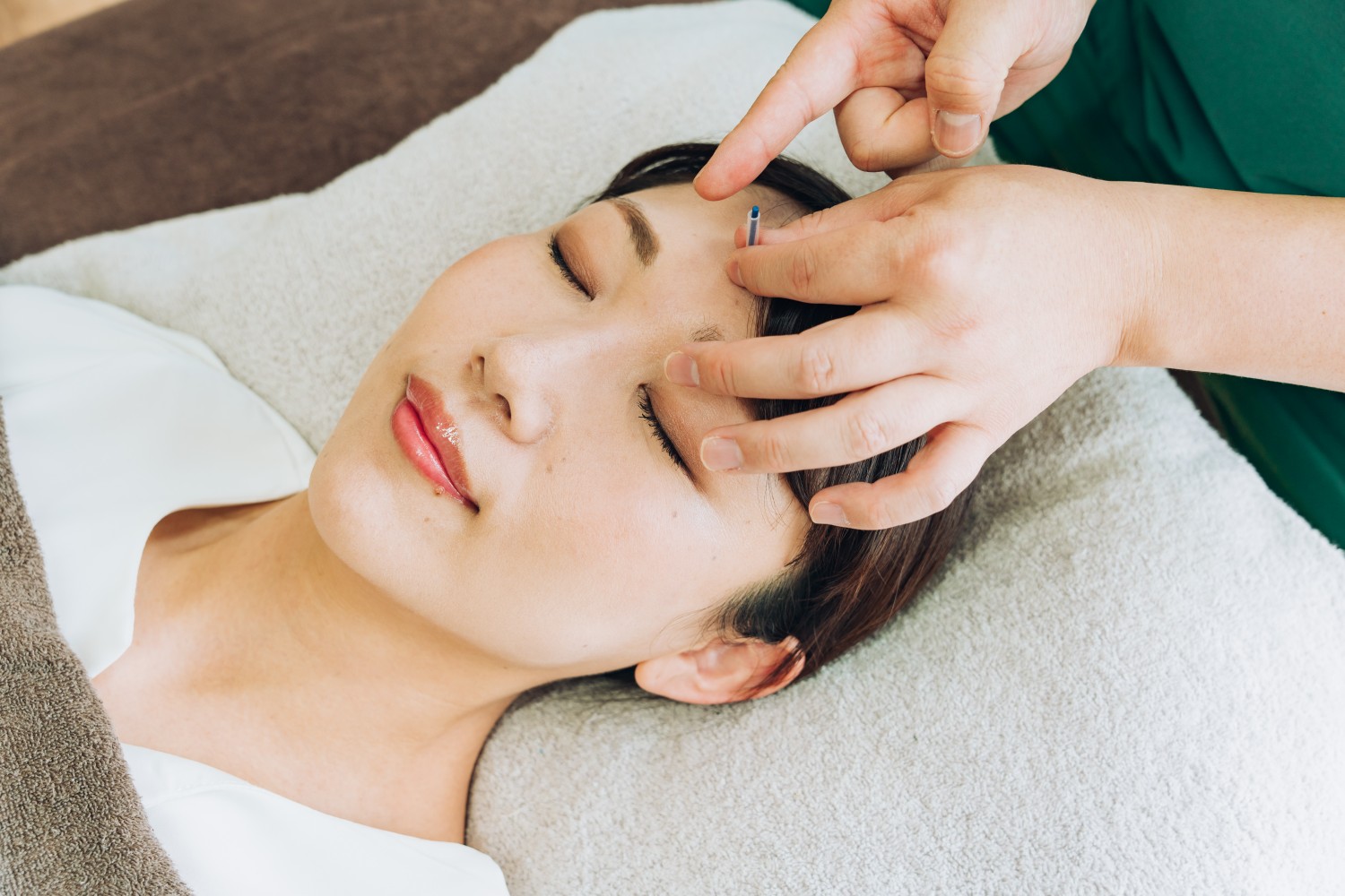 リズム鍼灸マッサージ院 頭皮への肌再生鍼のメニュー画像