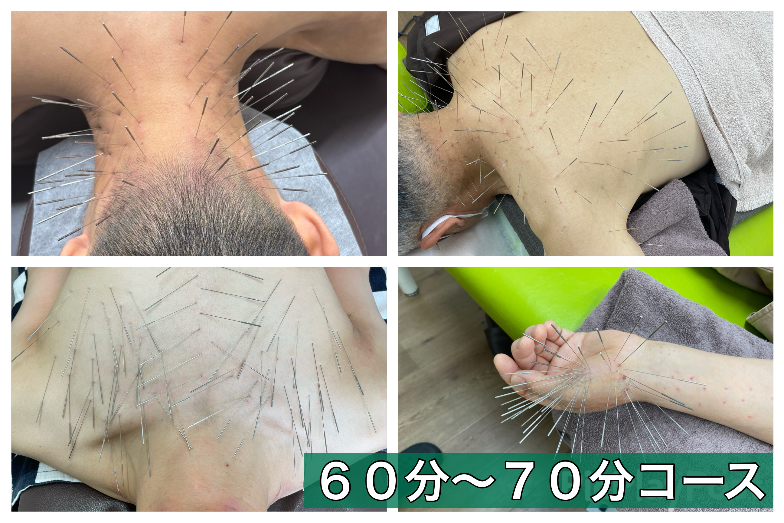 からだリメイク整骨院 【初回限定】ルート治療６０分~７０分コースのメニュー画像