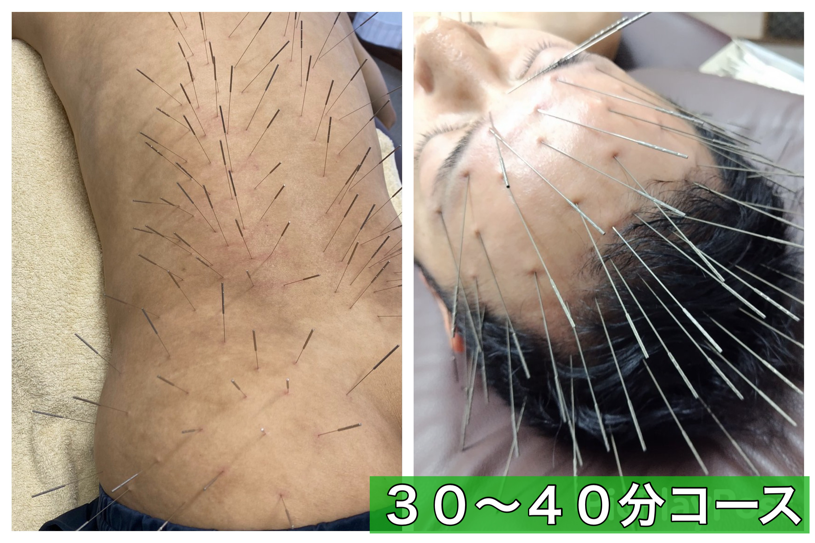 からだリメイク整骨院 ルート治療３０分~４０分コースのメニュー画像