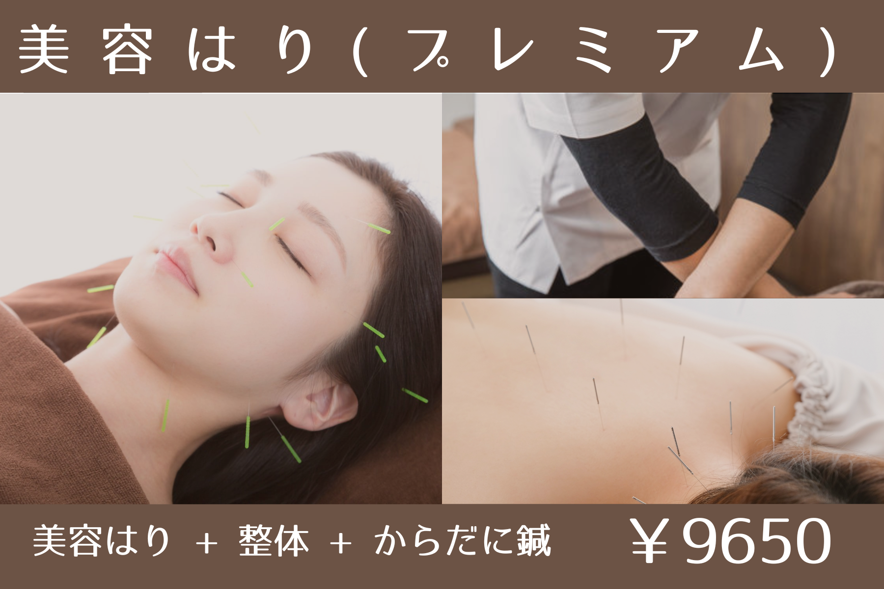 那覇市新都心スマイルなごみ鍼灸整骨院 美容はり【プレミアム】のメニュー画像