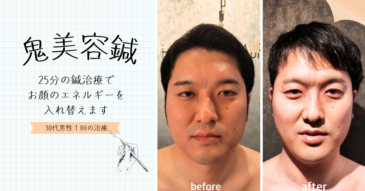 HARI CARE AURUM香川県丸亀市土器町 鬼美容鍼のメニュー画像