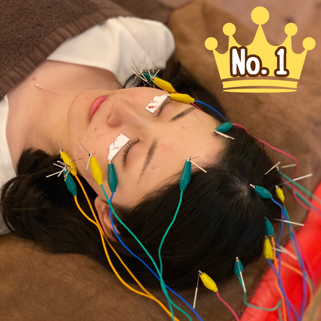 鍼灸マッサージLifeBuddy 【人気No１】お顔全体と頭に電気を流す美容鍼50本＋目の下の電気シールのメニュー画像