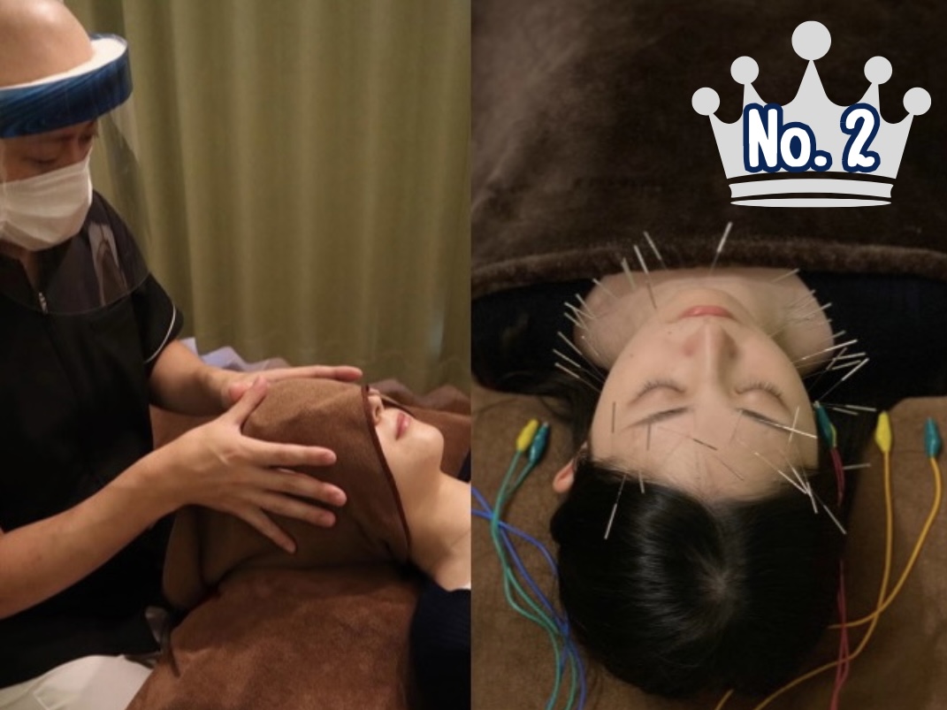 鍼灸マッサージLifeBuddy 【人気No２】お顔に電気を流す美容鍼24本＋30分鍼灸マッサージ施術のメニュー画像