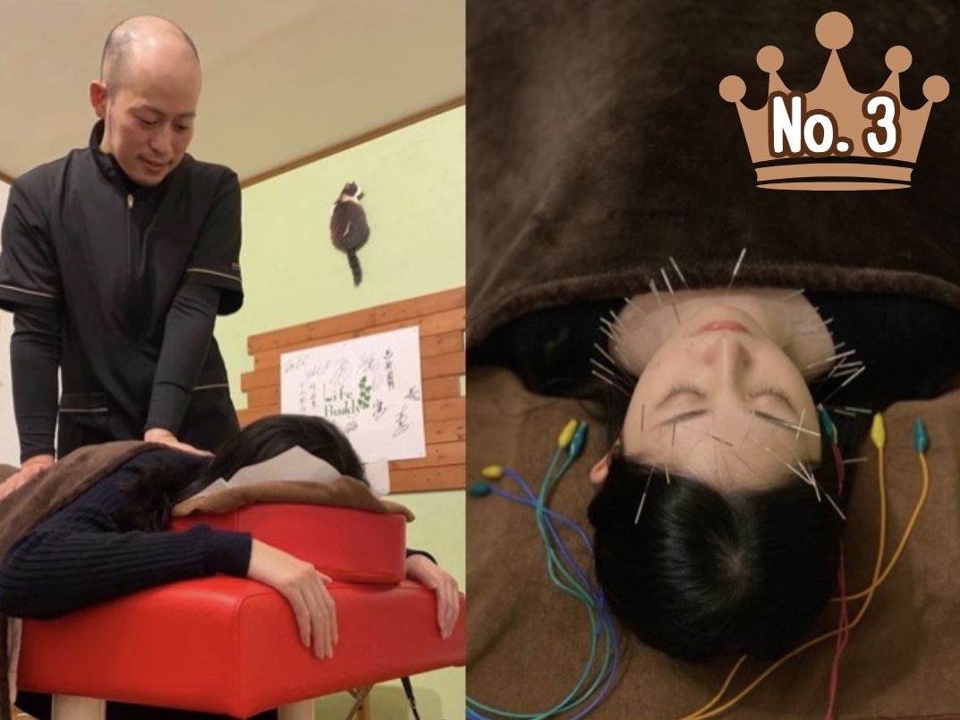 鍼灸マッサージLifeBuddy 【人気No3】お顔全体に電気を流す美容鍼42本＋60分鍼灸マッサージ施術のメニュー画像