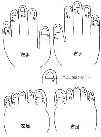 ラ・フィール治療院 せいけつ刺絡のメニュー画像